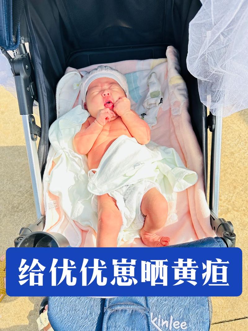 新生儿黄疸晒不到太阳，到底该如何科学应对才能退黄？-第1张图片-郑州医学网