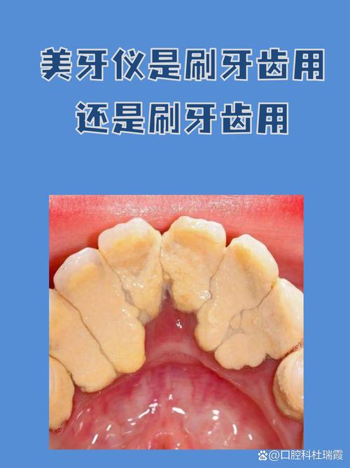 备孕期间使用美牙仪是否安全？对胎儿发育会有潜在影响吗？-第3张图片-郑州医学网