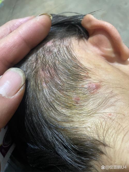 7岁孩子脑瘤早期症状有哪些？家长需警惕哪些异常信号？-第1张图片-郑州医学网