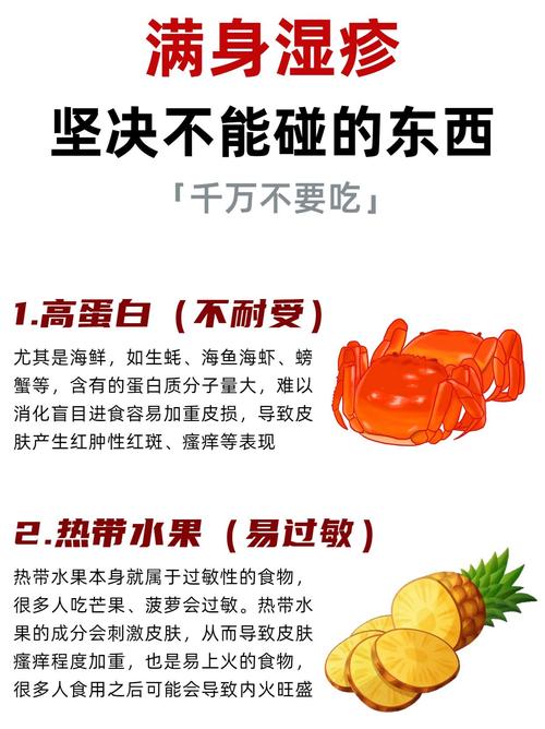 儿童湿疹忌口清单有哪些？这些食物真的需要完全避开吗？-第1张图片-郑州医学网