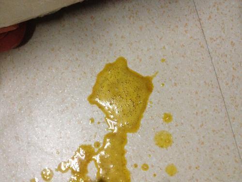 新生儿母乳大便带粘液是正常现象还是健康警报？-第3张图片-郑州医学网