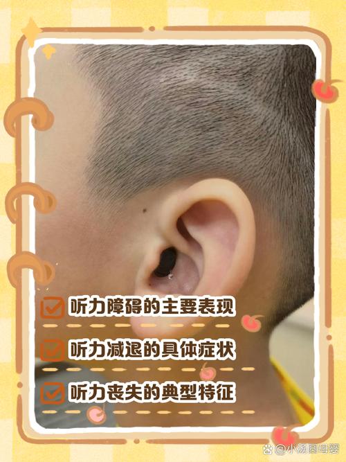 新生儿左耳测试未通过，该怎么办？需要立即就医吗？-第2张图片-郑州医学网