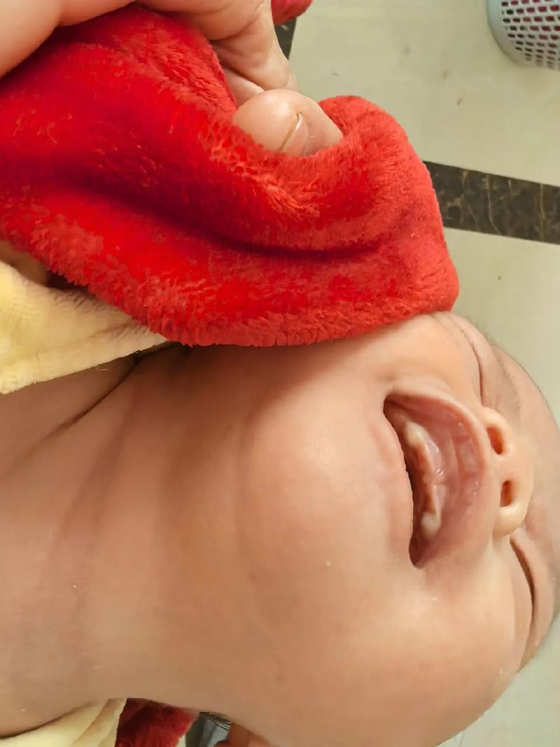 新生儿上牙龈发白图片是正常现象还是疾病信号？-第2张图片-郑州医学网