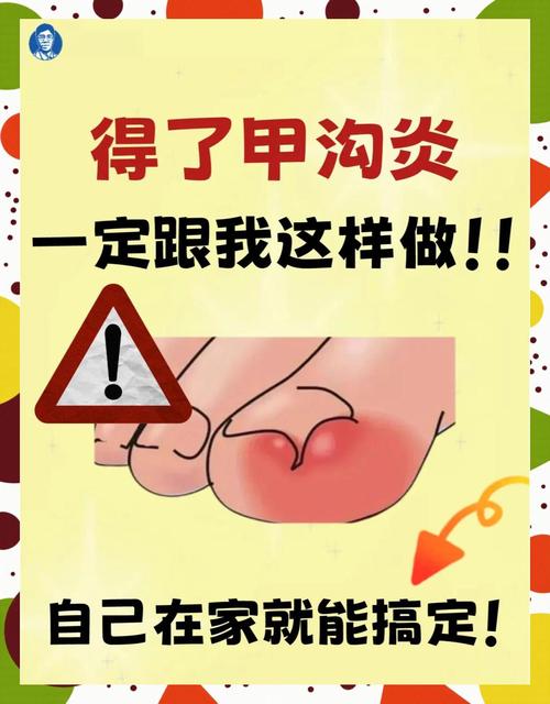 新生儿为什么会出现甲沟炎？这究竟与哪些因素有关？-第2张图片-郑州医学网