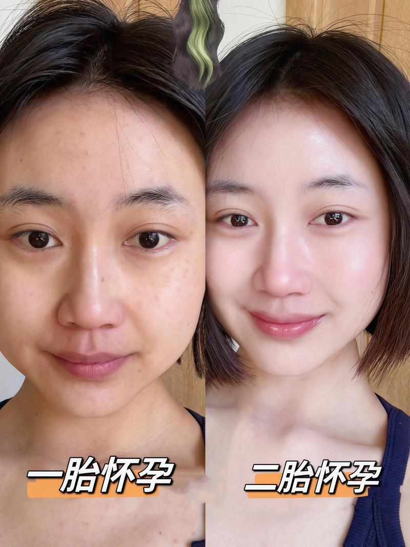 怀孕期间皮肤敏感又干燥，到底该怎么安全保养才有效？-第2张图片-郑州医学网