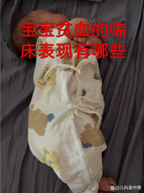 儿童再生性障碍性贫血的病因、治疗与预后有哪些关键问题？-第1张图片-郑州医学网