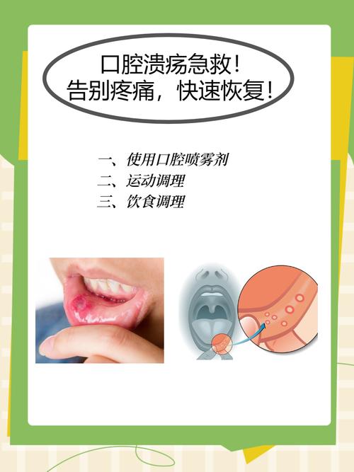 孕期怎么治疗口腔溃疡-第1张图片-郑州医学网