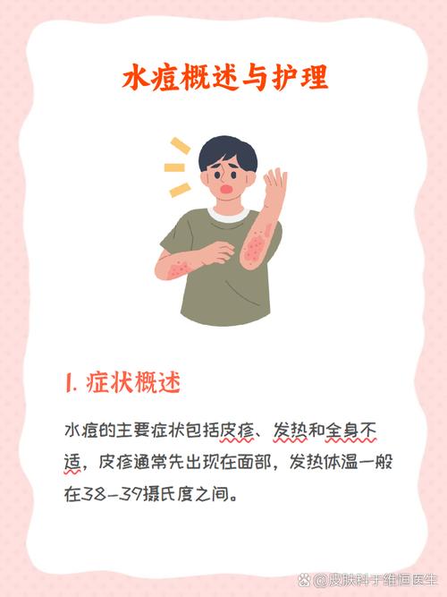 儿童起水痘发烧怎么办-第3张图片-郑州医学网