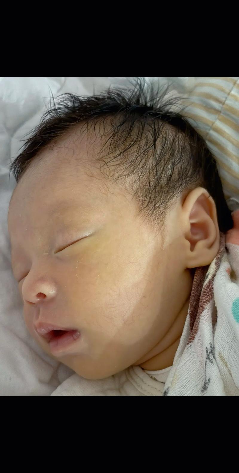 新生儿多久开始长肉肉-第1张图片-郑州医学网