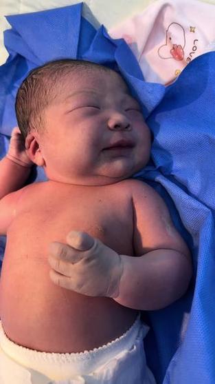 新生儿多久开始长肉肉-第3张图片-郑州医学网