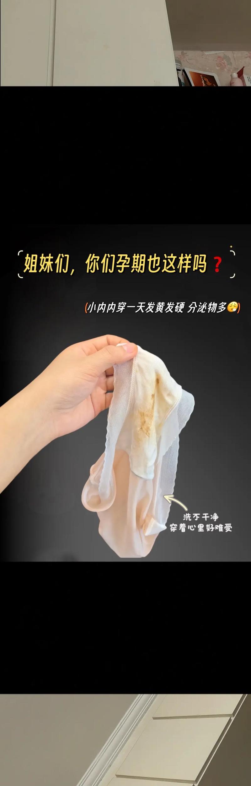 孕期出现黑色白带是正常现象吗?需警惕哪些异常情况?-第1张图片-郑州医学网 孕期出现黑色白带是正常现象吗?需警惕哪些异常情况?-第1张图片-郑州医学网