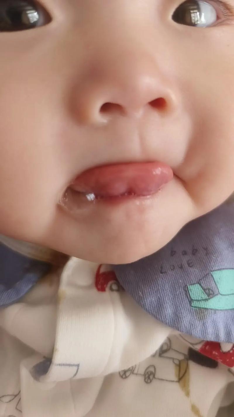 新生儿宝宝总爱含舌头，是正常发育还是有健康隐患？-第1张图片-郑州医学网