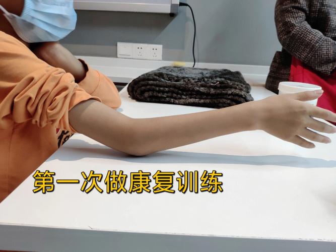 儿童肱骨髁上骨折后，何时开始锻炼？怎样锻炼才安全有效？-第3张图片-郑州医学网