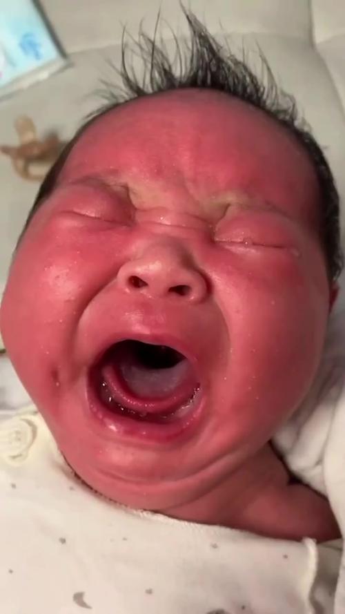 新生儿喝完奶哭闹蹬腿-第1张图片-郑州医学网