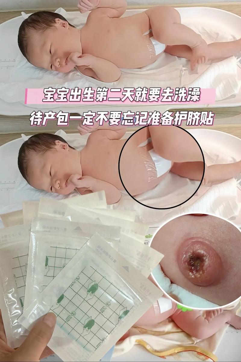 新生儿肚子上静脉明显是正常现象还是疾病信号？需要担心吗？-第1张图片-郑州医学网