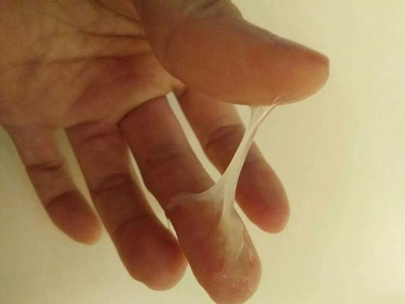 孕期白带一直呈白色是正常现象吗？会对胎儿有影响吗？-第2张图片-郑州医学网