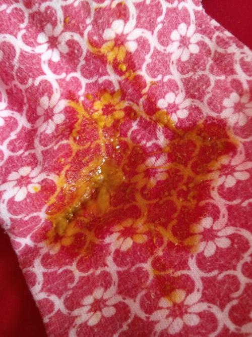 新生儿宝宝粑粑有红色是正常现象还是疾病信号？-第1张图片-郑州医学网