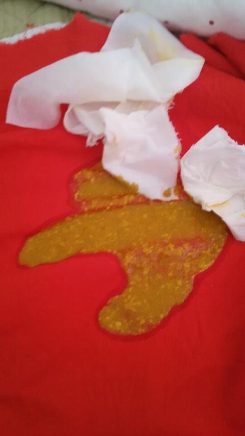 新生儿宝宝粑粑有红色是正常现象还是疾病信号？-第2张图片-郑州医学网