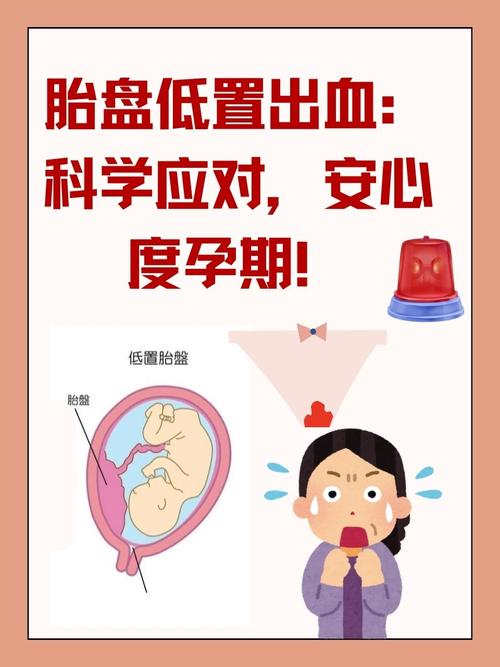 孕期流血到底会不会影响胎儿健康？不同情况下的风险差异有多大？-第3张图片-郑州医学网