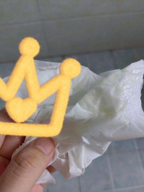 孕期白带变化正常吗？附不同阶段图片对比与注意事项-第1张图片-郑州医学网