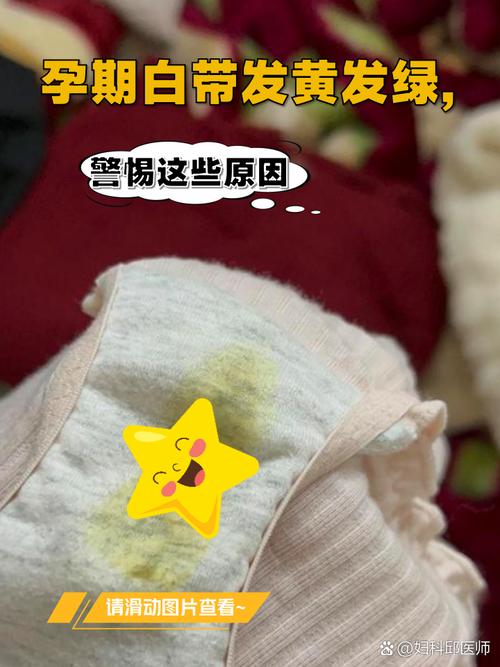 孕期白带变化正常吗？附不同阶段图片对比与注意事项-第3张图片-郑州医学网