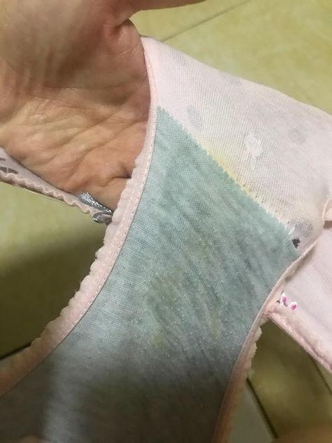 孕期白带变化正常吗？附不同阶段图片对比与注意事项-第2张图片-郑州医学网