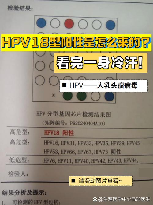 孕期发现HPV18阳性，宝宝会感染吗？需要终止妊娠吗？-第1张图片-郑州医学网