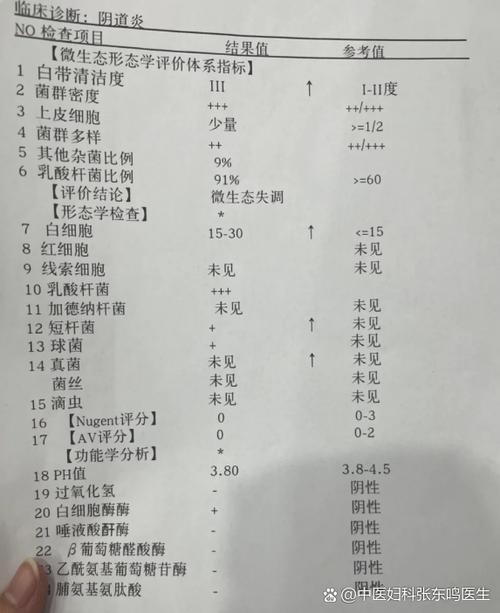 孕期尿白细胞125需要治疗吗？对胎儿有影响吗？-第1张图片-郑州医学网