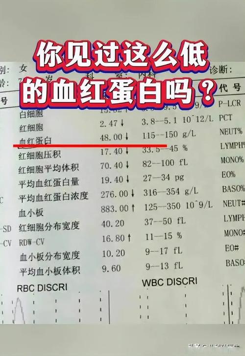 儿童贫血化验单怎么看？关键指标解读与应对方法有哪些？-第3张图片-郑州医学网