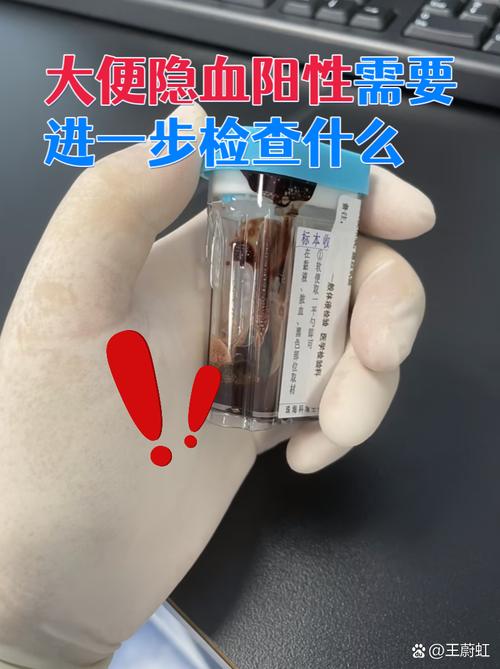 新生儿隐血试验弱阳性，需要担心吗？原因和后续处理要注意什么？-第2张图片-郑州医学网