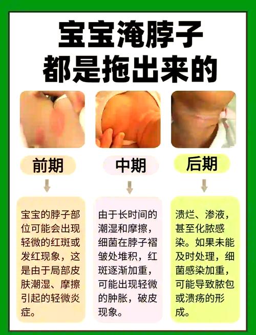 新生儿皮肤褶皱多，到底该怎么清洗才不会藏污纳垢还伤皮肤？-第3张图片-郑州医学网