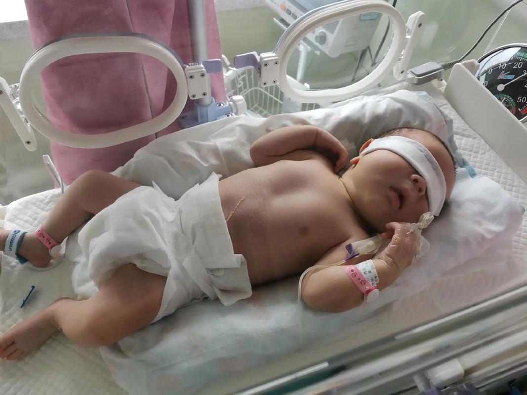 新生儿直接胆红素偏高到底严不严重？需要立即治疗吗？-第2张图片-郑州医学网