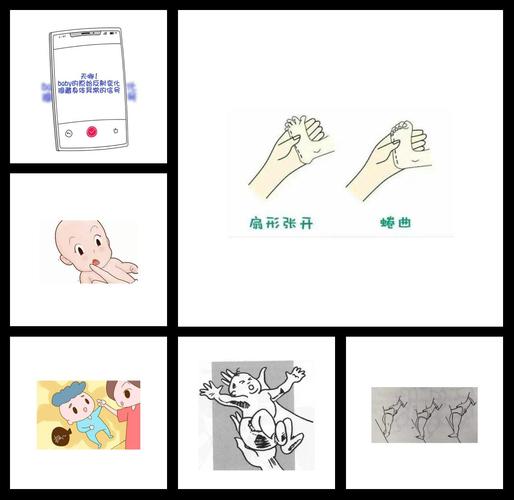 新生儿特有的神经反射有哪些?它们如何反映宝宝的健康状况?-第2张图片-郑州医学网 新生儿特有的神经反射有哪些?它们如何反映宝宝的健康状况?-第2张图片-郑州医学网