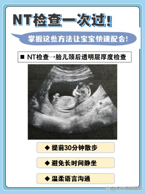 孕期做NT检查具体是查什么？对胎儿发育有何意义？-第1张图片-郑州医学网