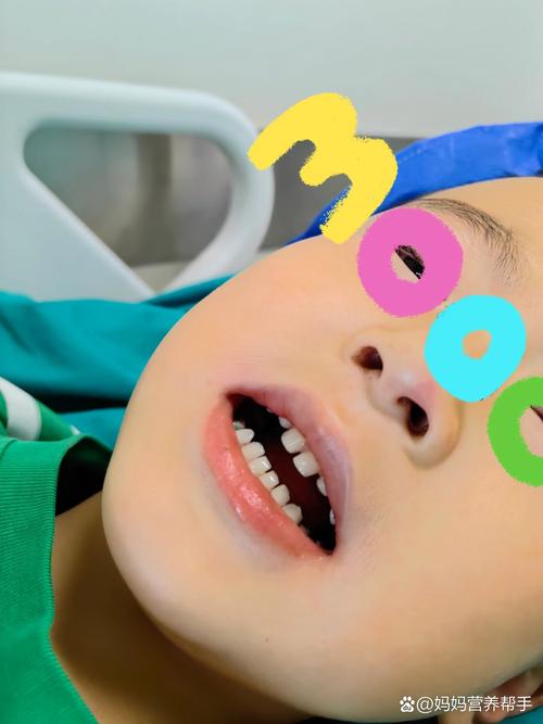 全麻补牙会对儿童的身体发育和认知功能产生哪些潜在影响？-第3张图片-郑州医学网