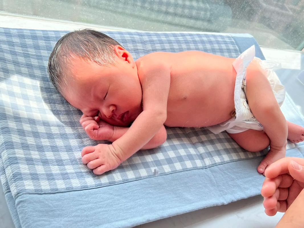 新生儿黄疸晒太阳，晒多久、晒哪里、注意啥？科学退黄有讲究！-第2张图片-郑州医学网