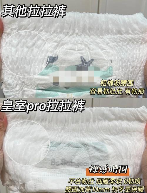 新生儿尿结晶需要处理吗？会对宝宝健康有影响吗？-第1张图片-郑州医学网