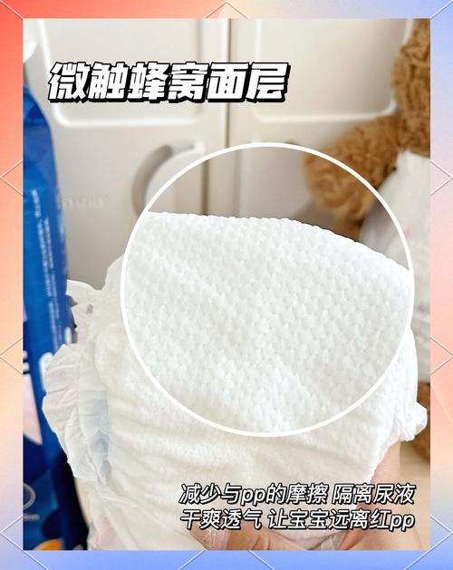 新生儿尿结晶需要处理吗？会对宝宝健康有影响吗？-第2张图片-郑州医学网