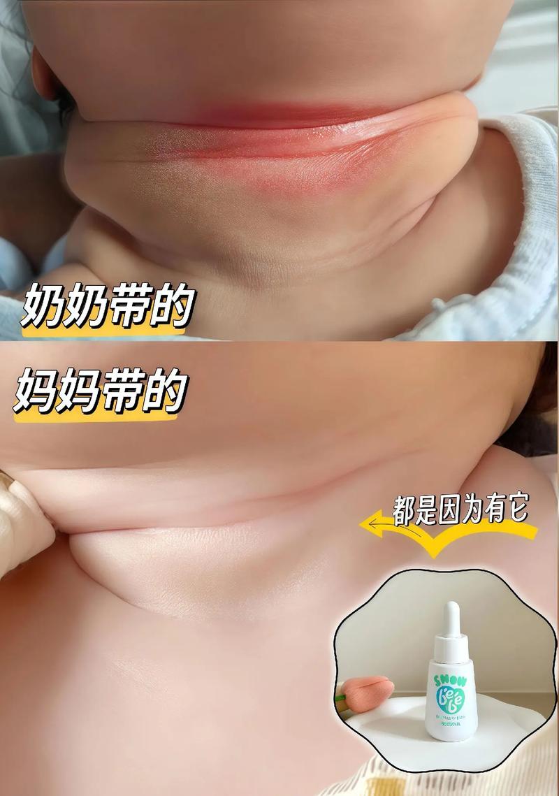 新生儿衣服总是漏脖子-第2张图片-郑州医学网