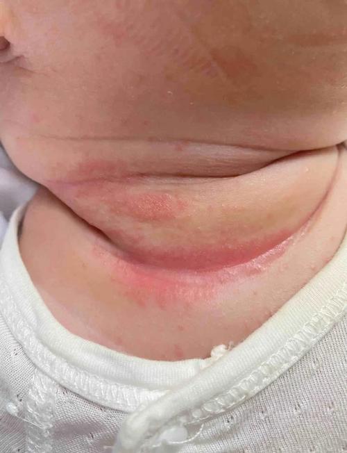 新生儿衣服总是漏脖子-第3张图片-郑州医学网