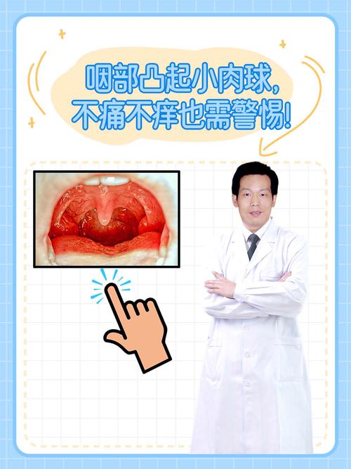 儿童喉咙长息肉怎么办？需手术吗？日常护理要注意什么？-第1张图片-郑州医学网