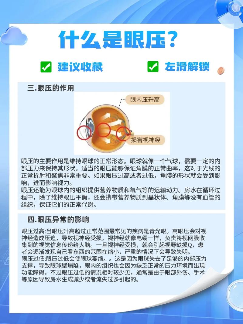 儿童眼压高是什么原因？是先天发育异常还是后天用眼习惯导致的？-第2张图片-郑州医学网