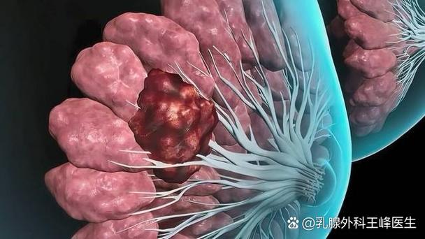 孕期多发性乳腺纤维瘤会随孕周增大吗？孕期发现乳腺纤维瘤需要立即手术吗？-第2张图片-郑州医学网