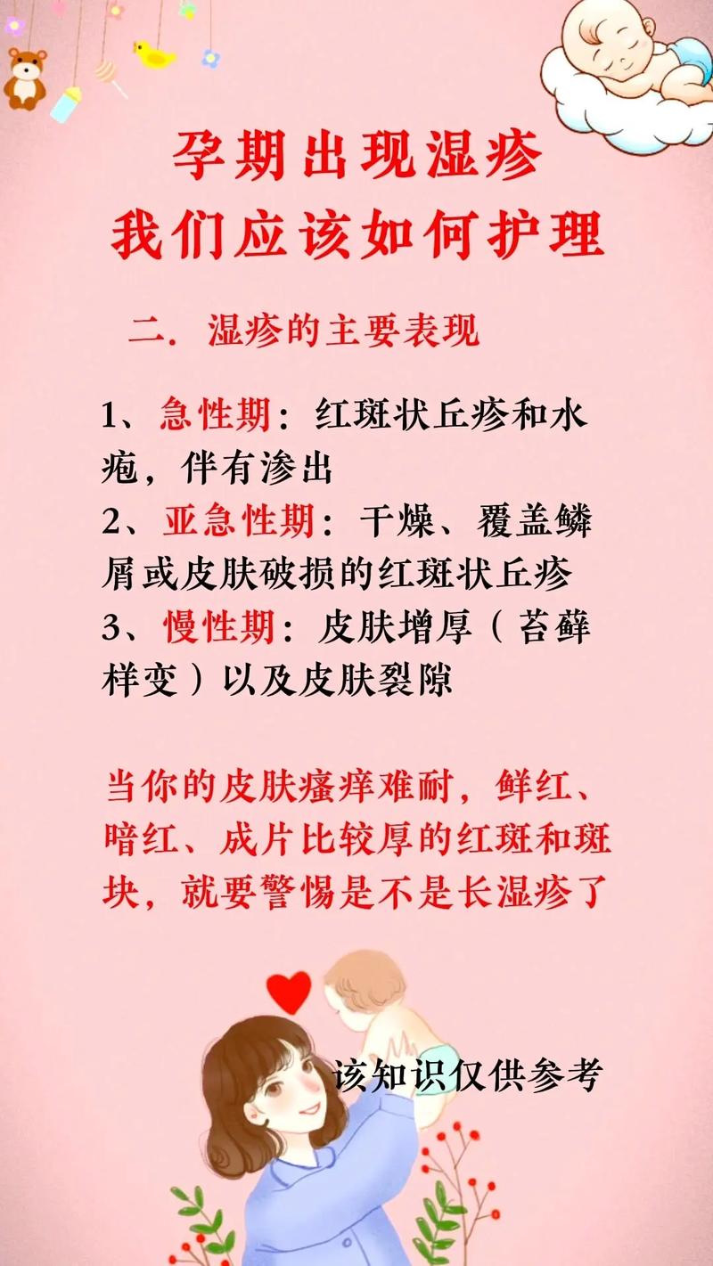 孕期湿疹发作，涂抹芦荟胶真的安全有效吗？-第2张图片-郑州医学网