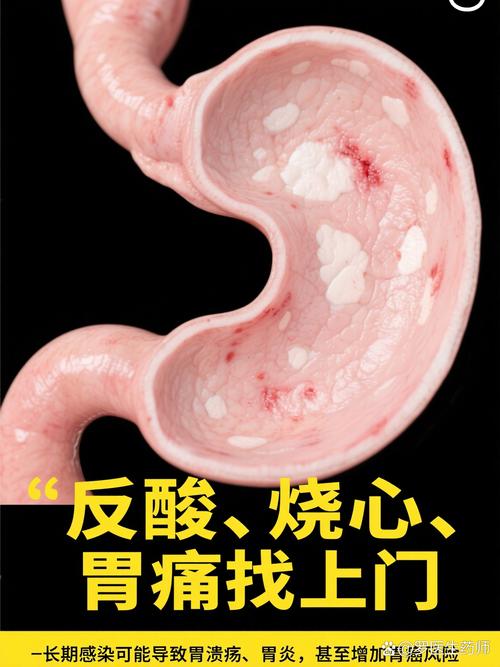 怀孕期间感染幽门螺旋杆菌会对胎儿造成哪些影响?-第1张图片-郑州医学网 怀孕期间感染幽门螺旋杆菌会对胎儿造成哪些影响?-第1张图片-郑州医学网