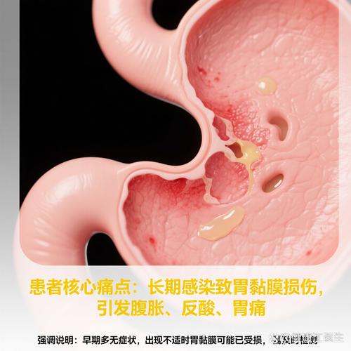 怀孕期间感染幽门螺旋杆菌会对胎儿造成哪些影响？-第2张图片-郑州医学网