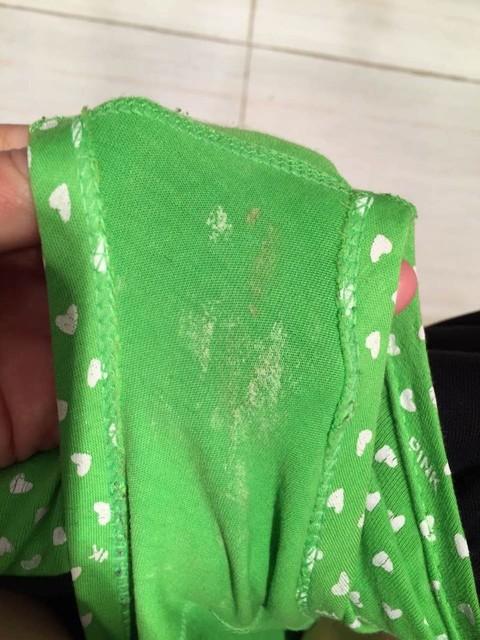 孕期白带发绿是感染信号吗？需要立即就医处理吗？-第1张图片-郑州医学网