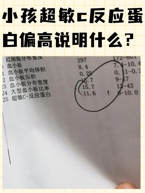 儿童血常规反应蛋白高,到底意味着什么?是感染还是其他问题?-第2张图片-郑州医学网 儿童血常规反应蛋白高,到底意味着什么?是感染还是其他问题?-第2张图片-郑州医学网