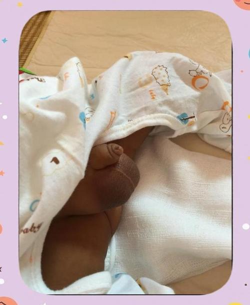 新生儿蛋蛋一大一小是正常现象还是疾病信号？需要就医检查吗？-第1张图片-郑州医学网