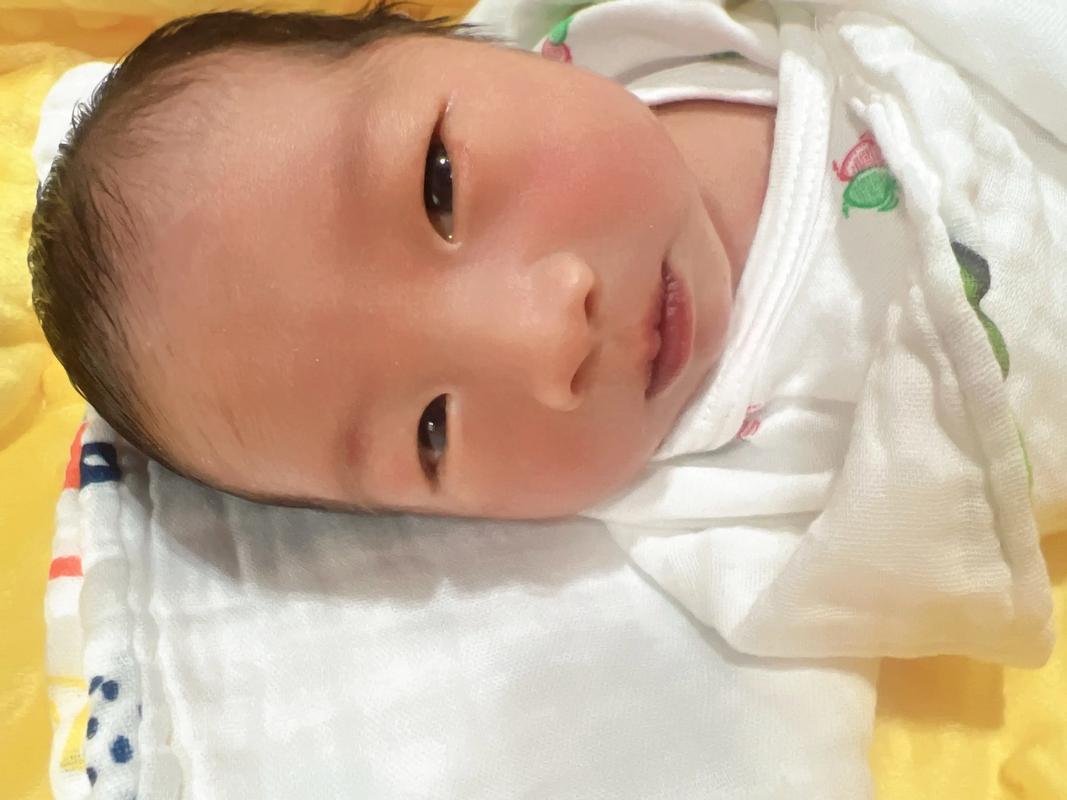 新生儿一个月黄疸12mg/dl还没退怎么办？需要治疗吗？-第1张图片-郑州医学网